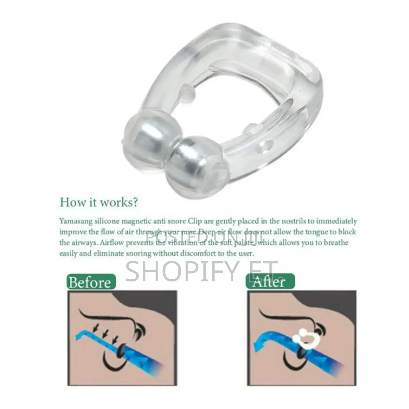Anti Snoring Device (ሲተኙ ለሚያንኮራፉ ዘላቂ መፍትሄ)