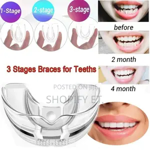 Teeth Alignment (በማይታመን ዋጋ)