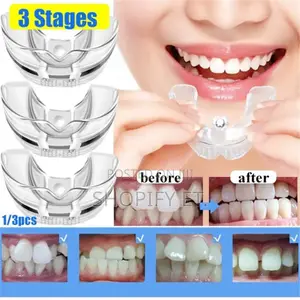 Teeth Alignment (በማይታመን ዋጋ)