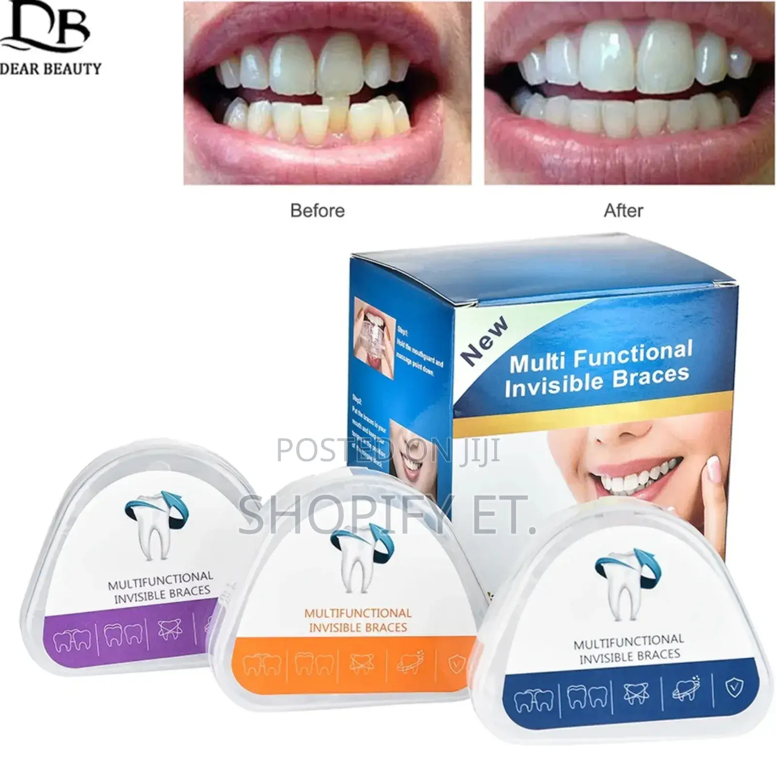 Teeth Alignment (በማይታመን ዋጋ)