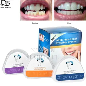 Photo - Teeth Alignment (በማይታመን ዋጋ)