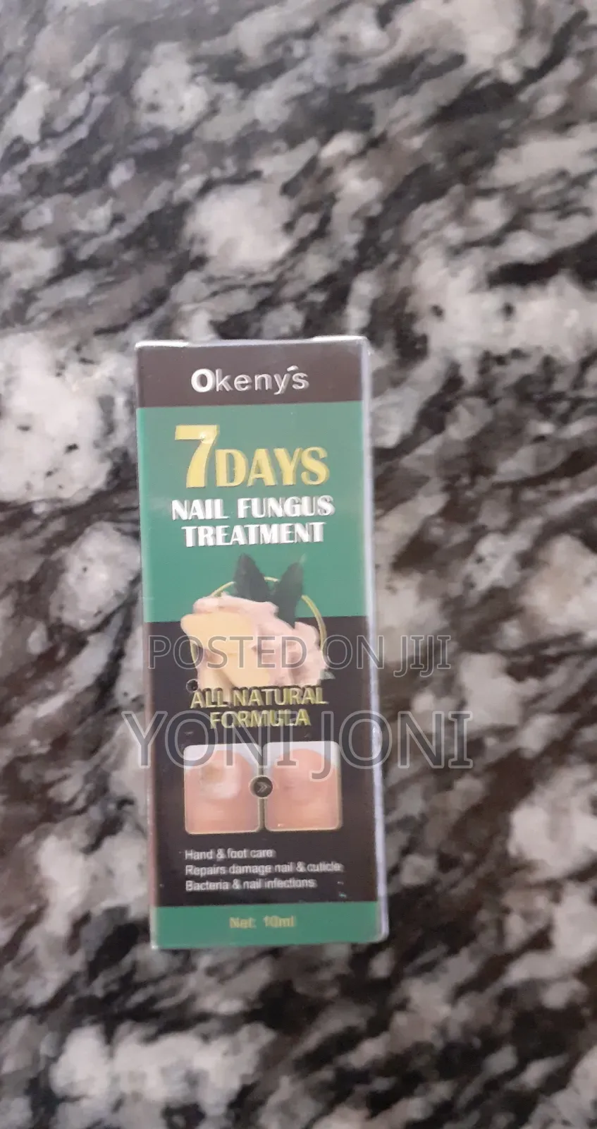 Nail Fungus Treatment ለ ጥፍረ መጥምጥ