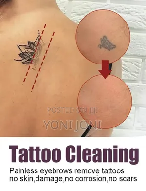Photo - ንቅሳት ማጥፊያ Tatoo Cleaner