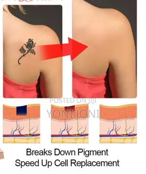 ንቅሳት ማጥፊያ Tatoo Cleaner