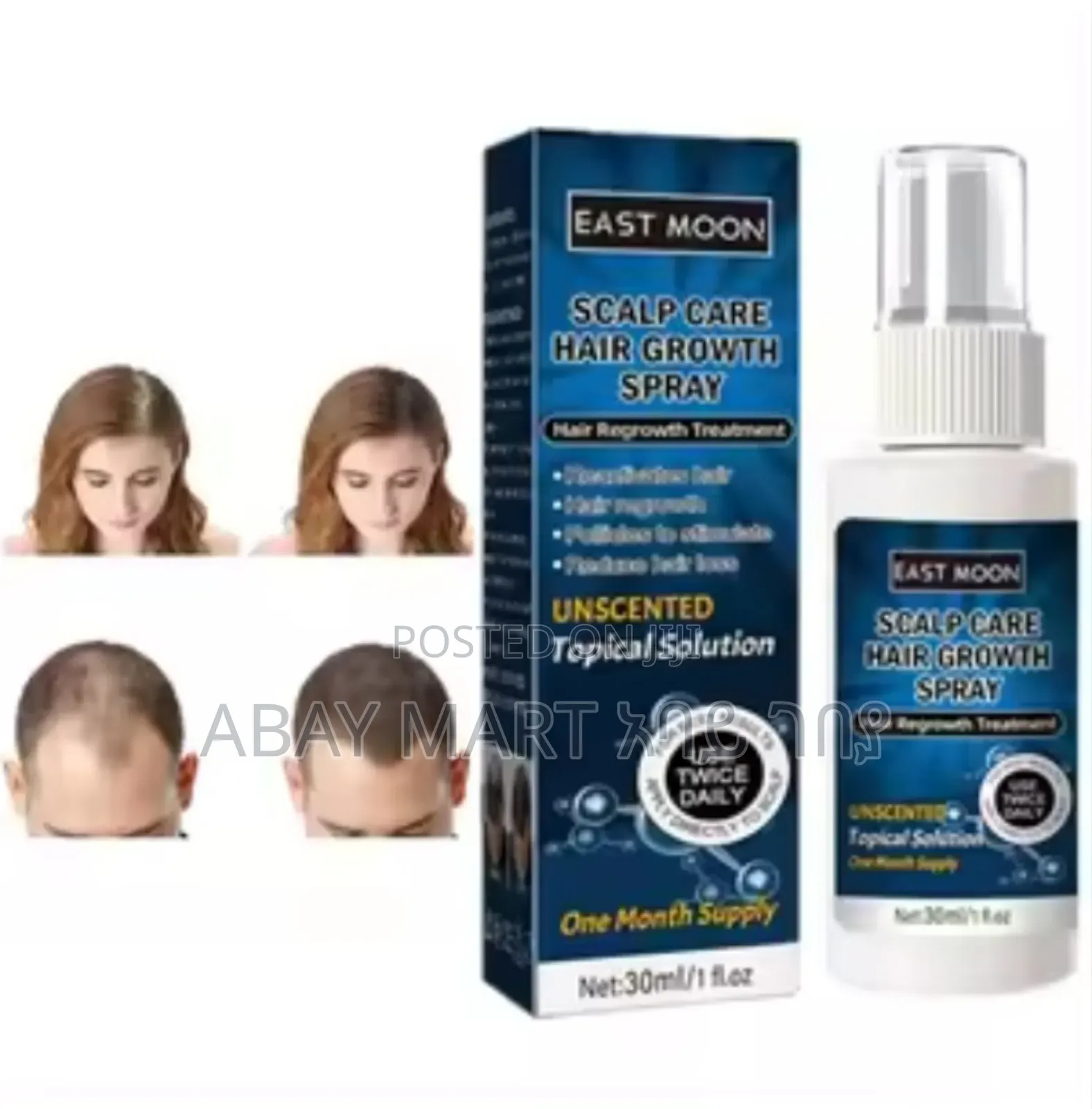 East Moon Hair Growth Spray