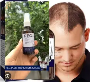 Photo - FEG Hair Growth Spray Within 14 Days