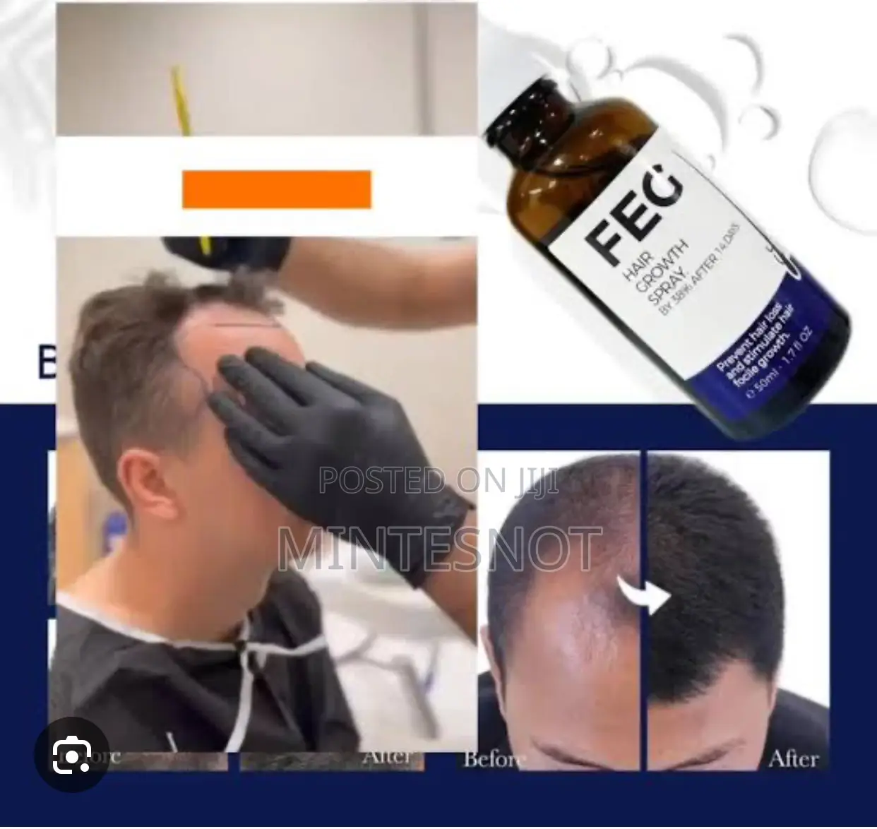 FEG Hair Growth Spray Within 14 Days
