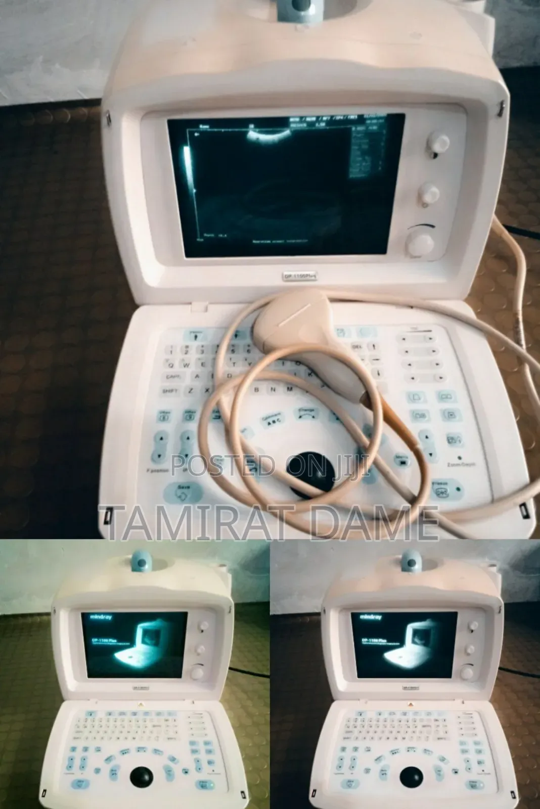 Mindray Dp11 Ultrasound