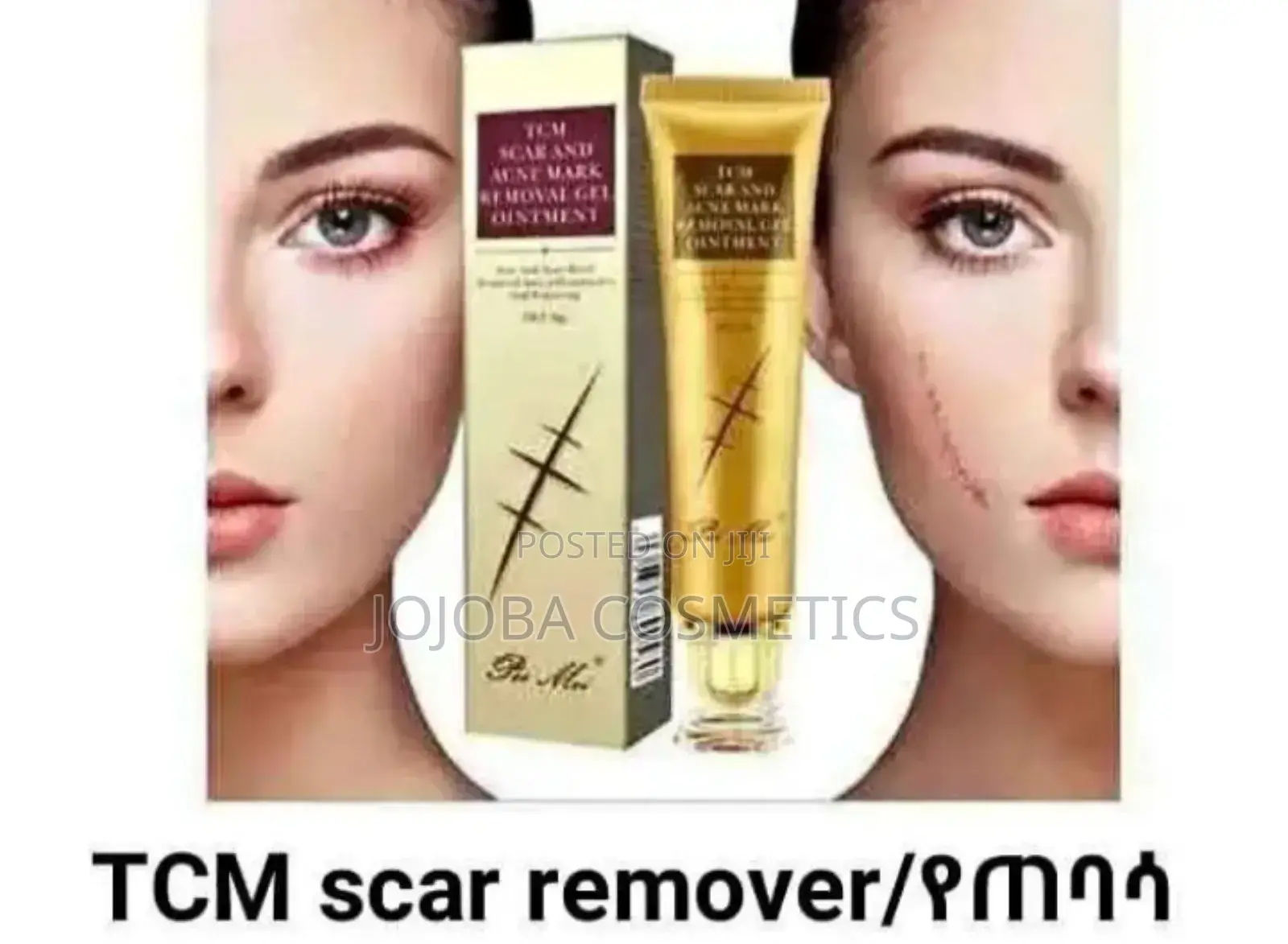 TCM Scar Removal