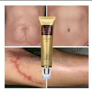 TCM Scar Removal
