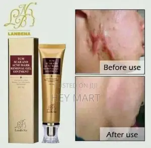 TCM Scar and Acne Mark Removal Gel