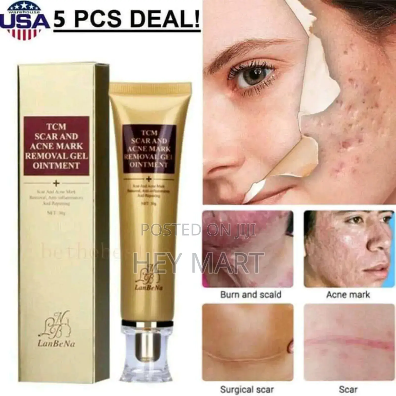 TCM Scar and Acne Mark Removal Gel