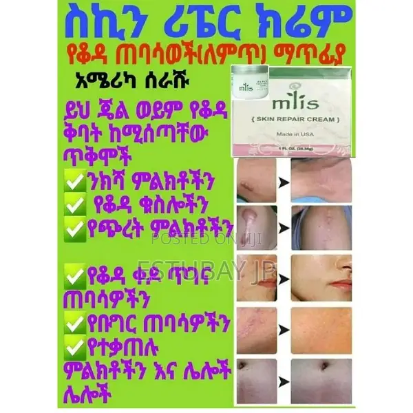 ለጠባሳ በእሳት ለጠቃጠለ ሰውነት M’Lis Cream-Skin Repair Cream