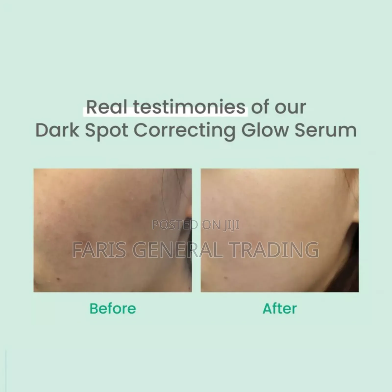 Axis – Y – Dark Spot Correcting Glow Serum