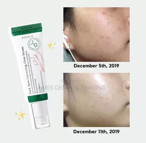 Axis – Y – Dark Spot Correcting Glow Serum