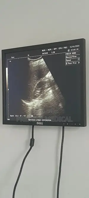 Photo - Ultrasound Display (Additional Screen)