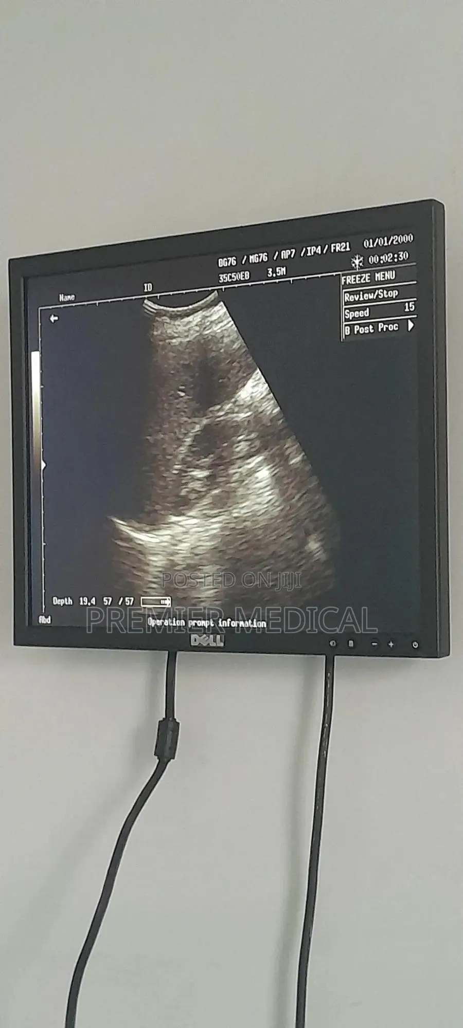 Ultrasound Display (Additional Screen)