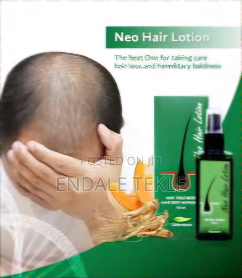 Neo Hair Lotion ፈጣን እና በአጭር ጊዜ ለውጥ የሚያዩበት