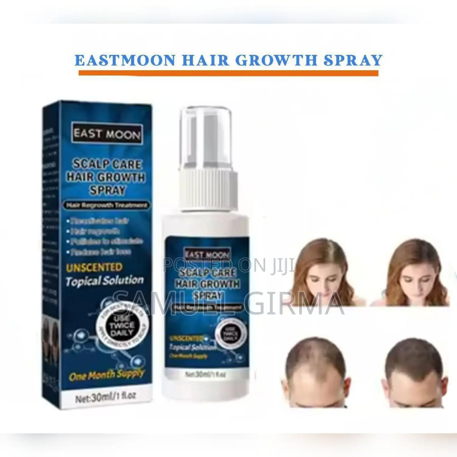 Eastmoon Hair Growth Spray
