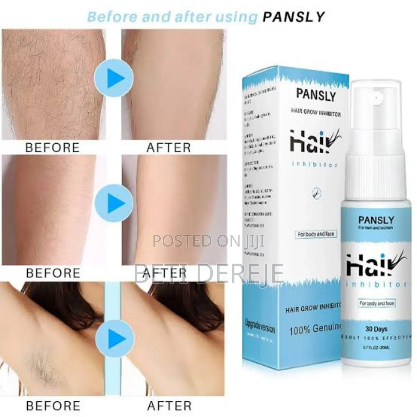 Pansly Hair Growth Inhibitor