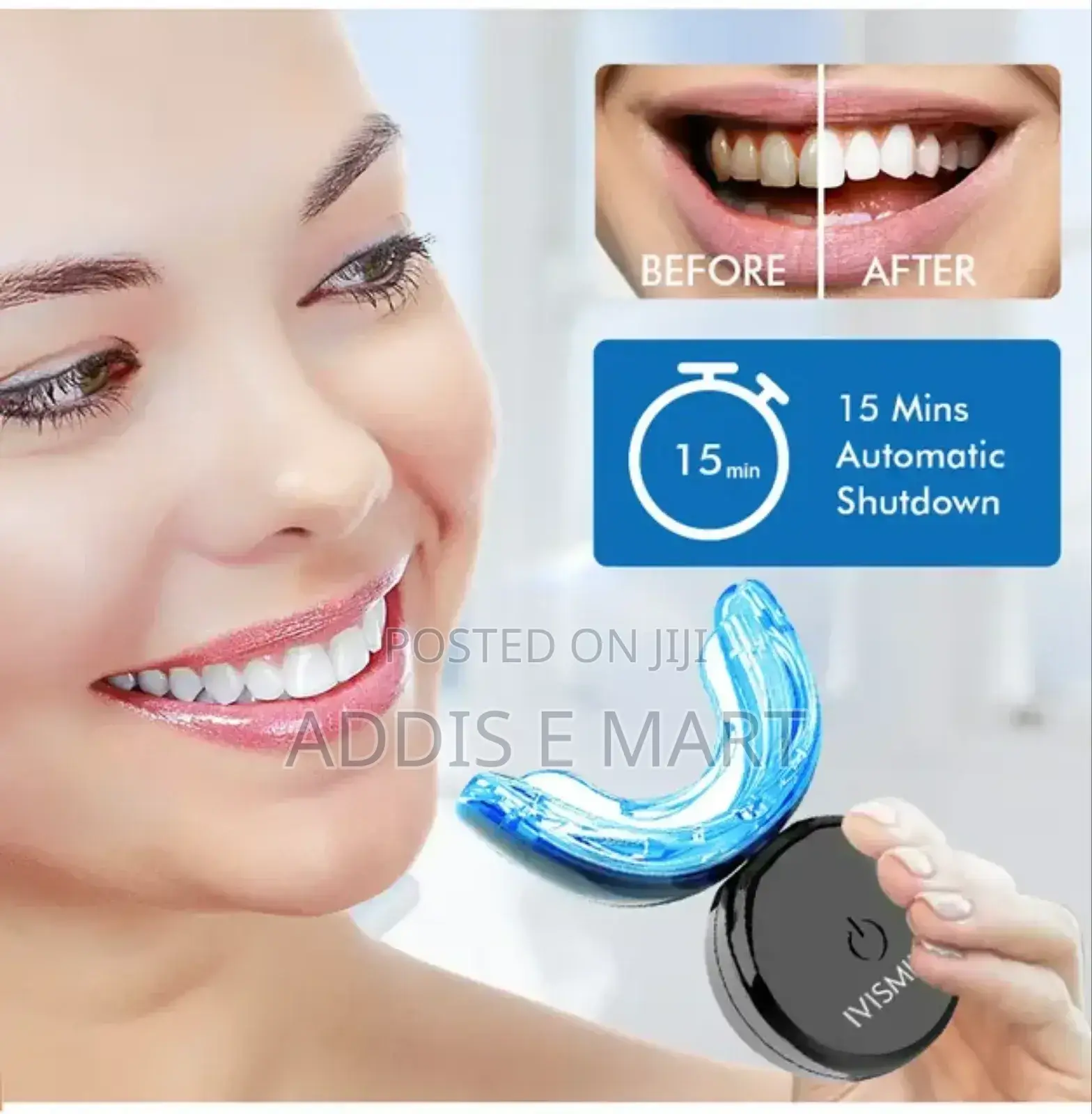 የተዛባ ጥርስ ማስተካከያ (Soft and Hard )