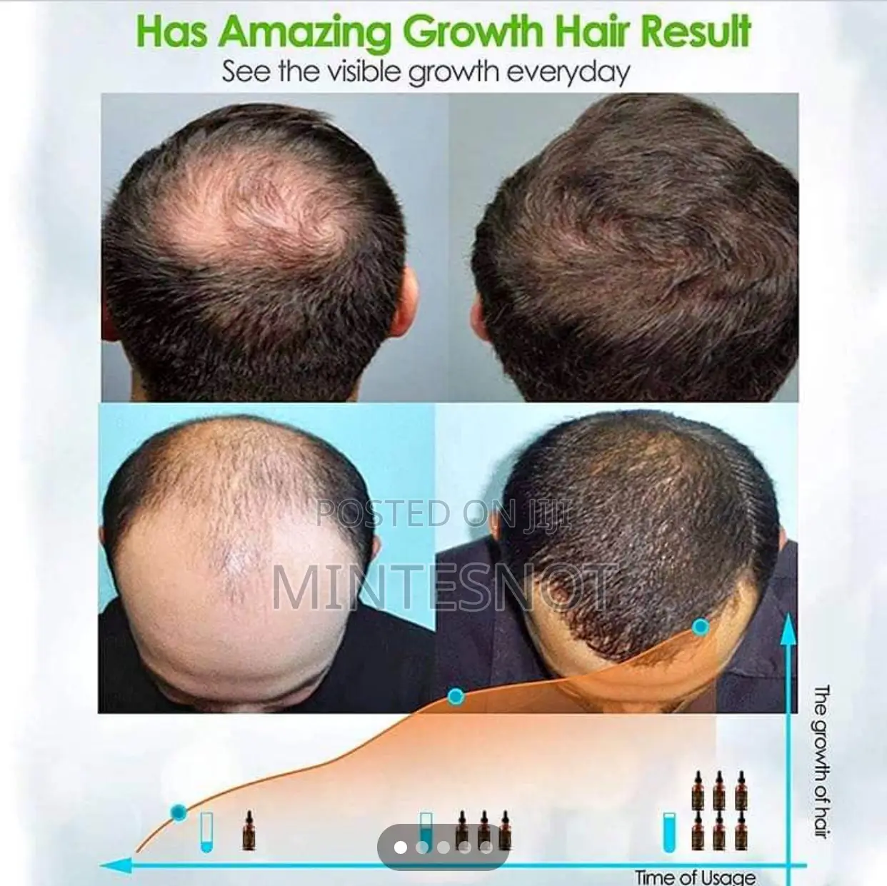 FEG Standard Hair Growth Spray 