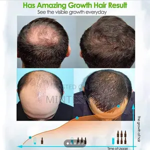 Photo - FEG Standard Hair Growth Spray 