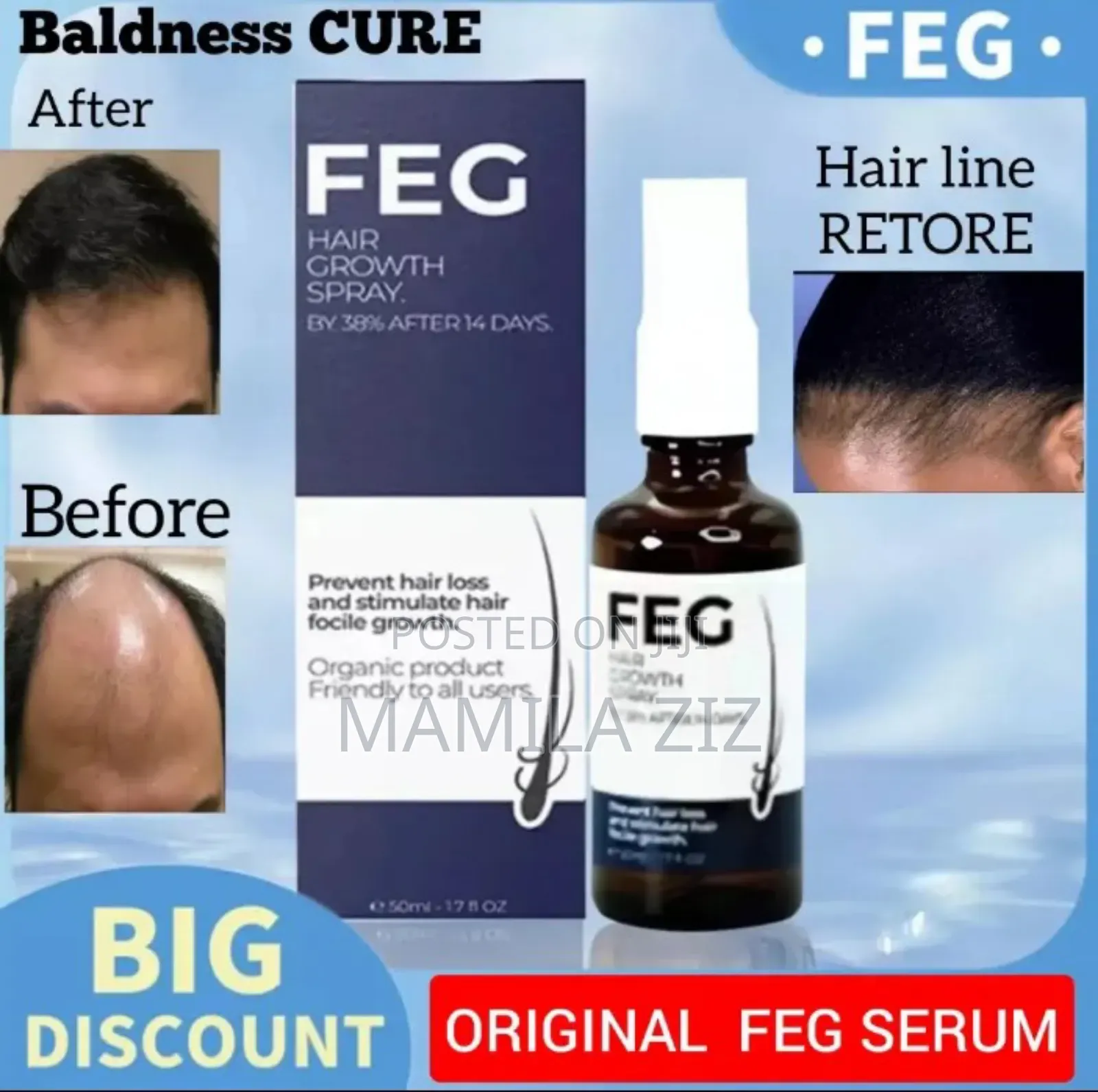 Feg የፀጉር ማብቀያ