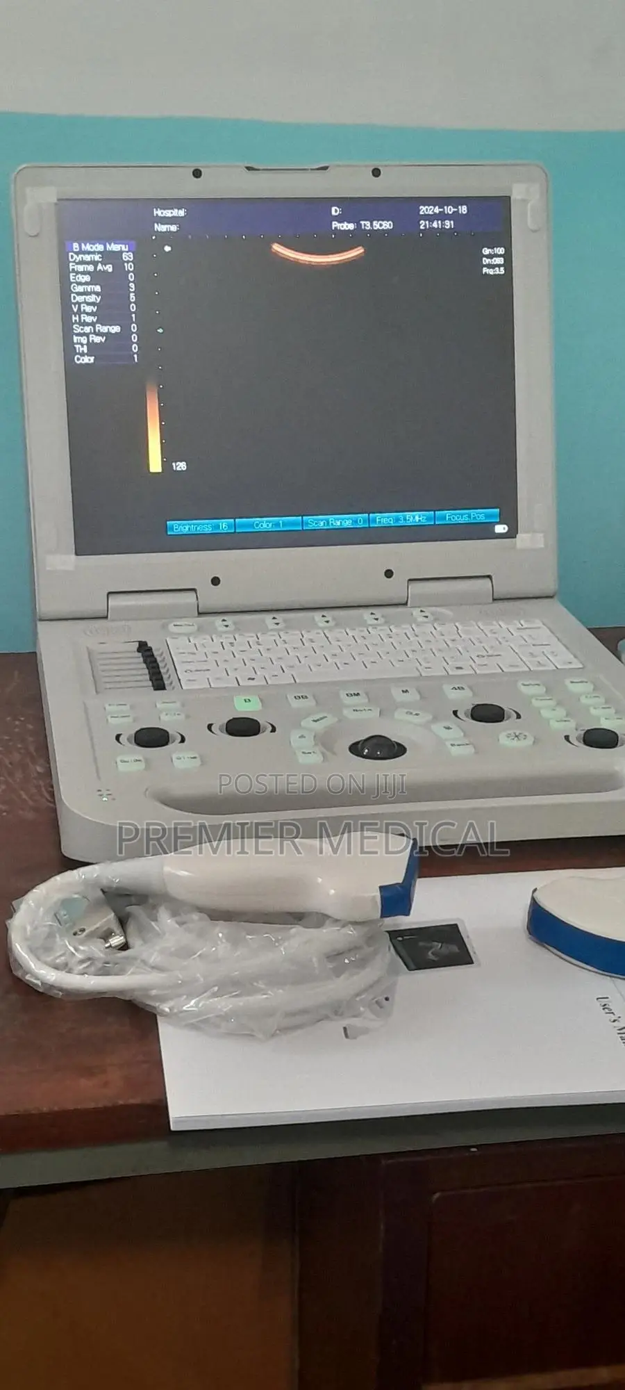 Sonostar Ultrasound Machine