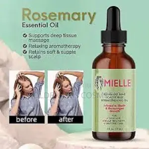 Photo - MIELLE Rosemary Mint Scalp Hair Strengthening Oil