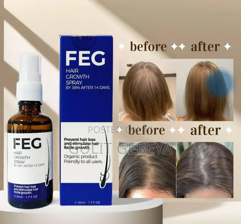 Feg የ ፀጉር ማብቀያ