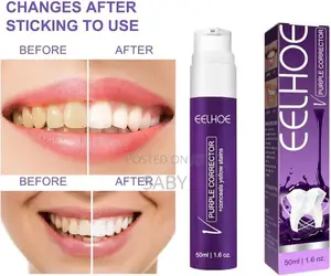 Photo - Eelhoe Purple Tooth Whitening Paste