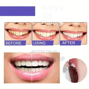 Photo - Eelhoe Purple Corrector for Teeth