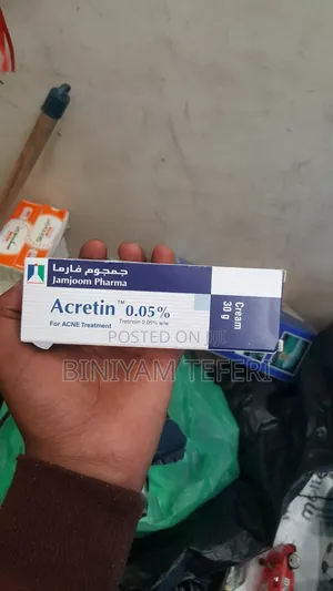 Acretin Acne Removal
