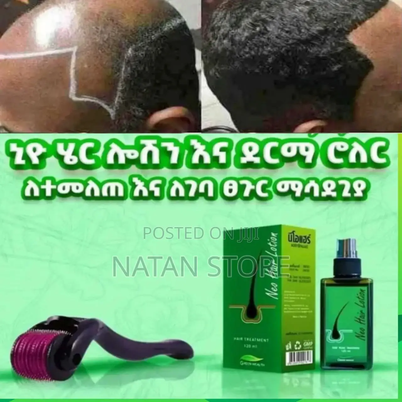 አስደናቂው የፀጉርና ፂም ማሳደግያ NEO Hair Regrowth