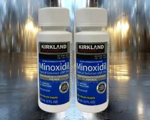 Minoxidil Modern Treatment for Baldness