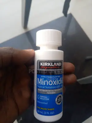 Photo - The Most Efective Type of Hair Treatmeent Oil Minoxidil 5%