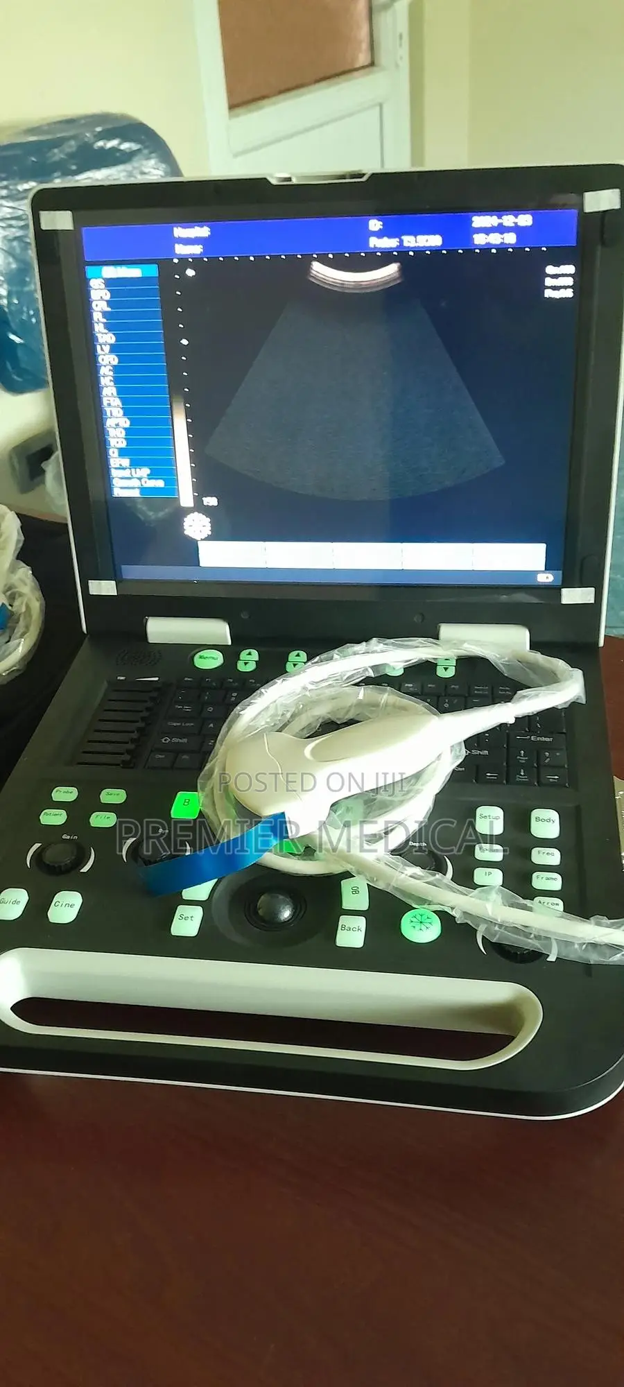 Sonostar Ultrasound Machine