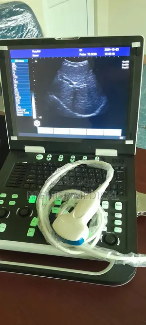 Sonostar Ultrasound Machine