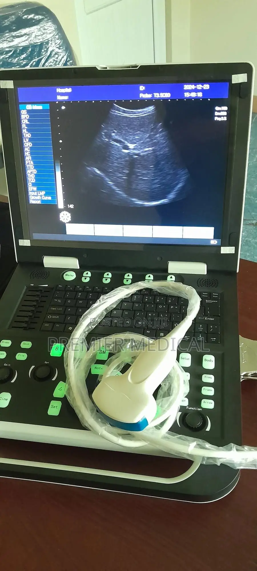 Sonostar Ultrasound Machine