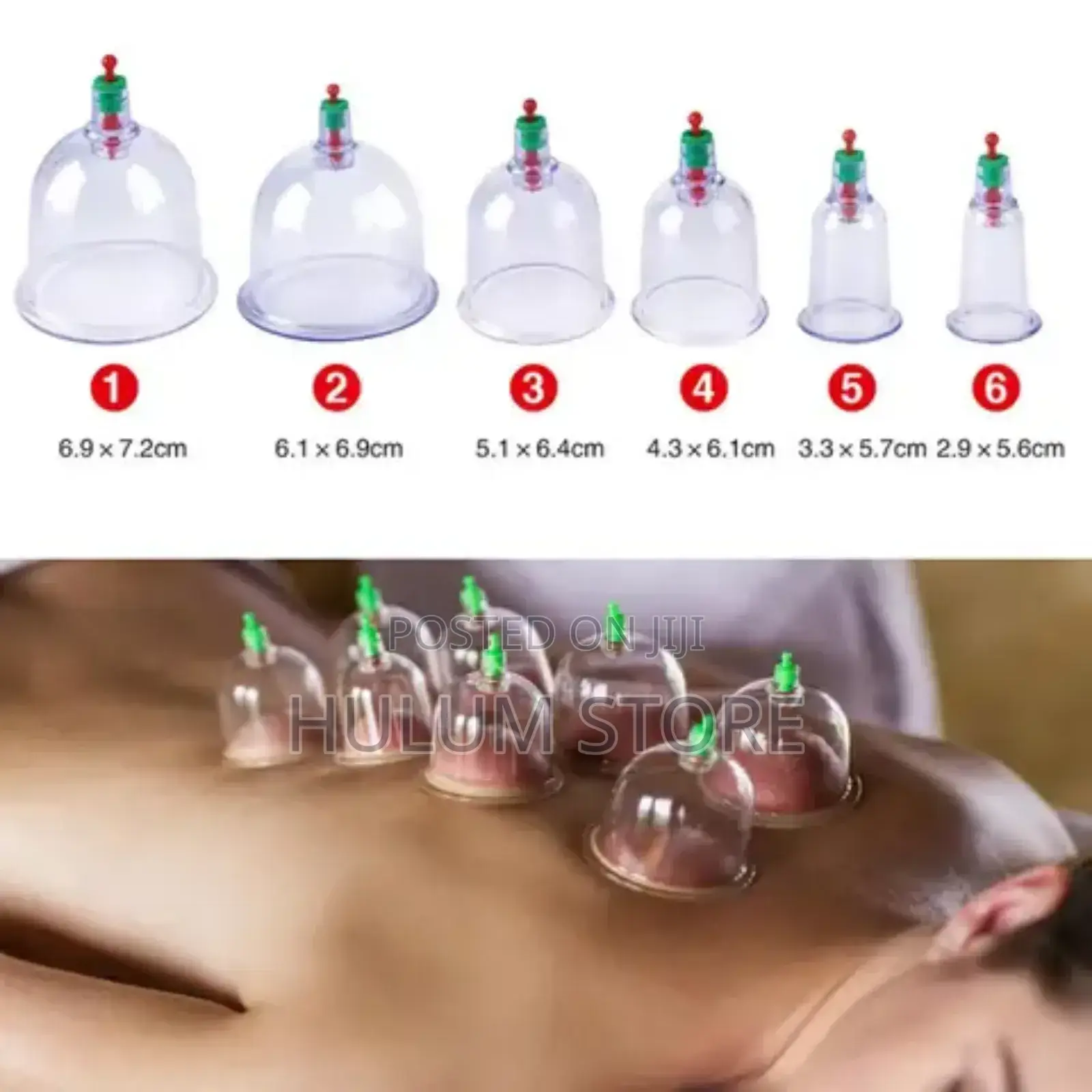 12 Cup Set Chinese Medical Vacuum Therapy