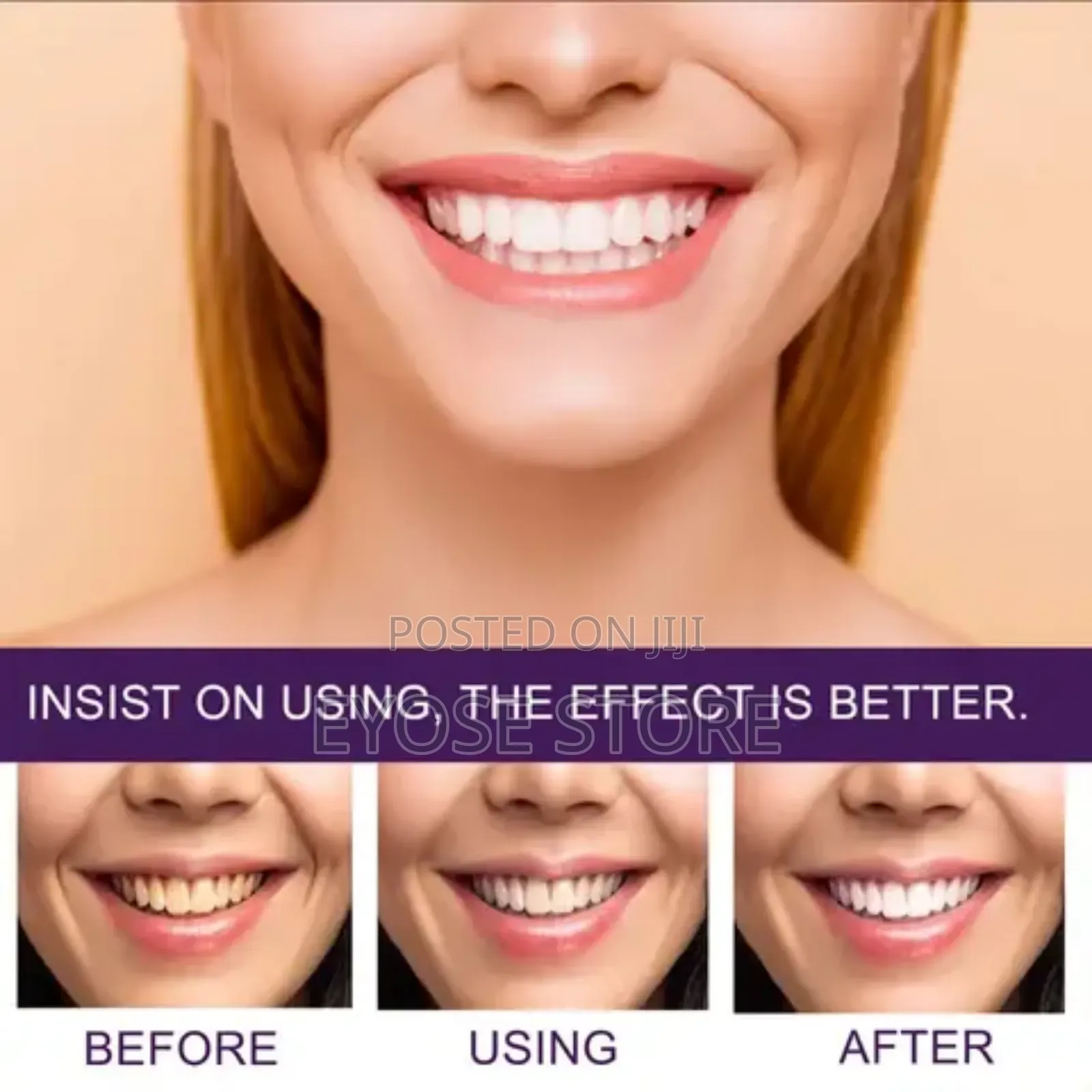 Eelhoe Purple Corrector for Teeth