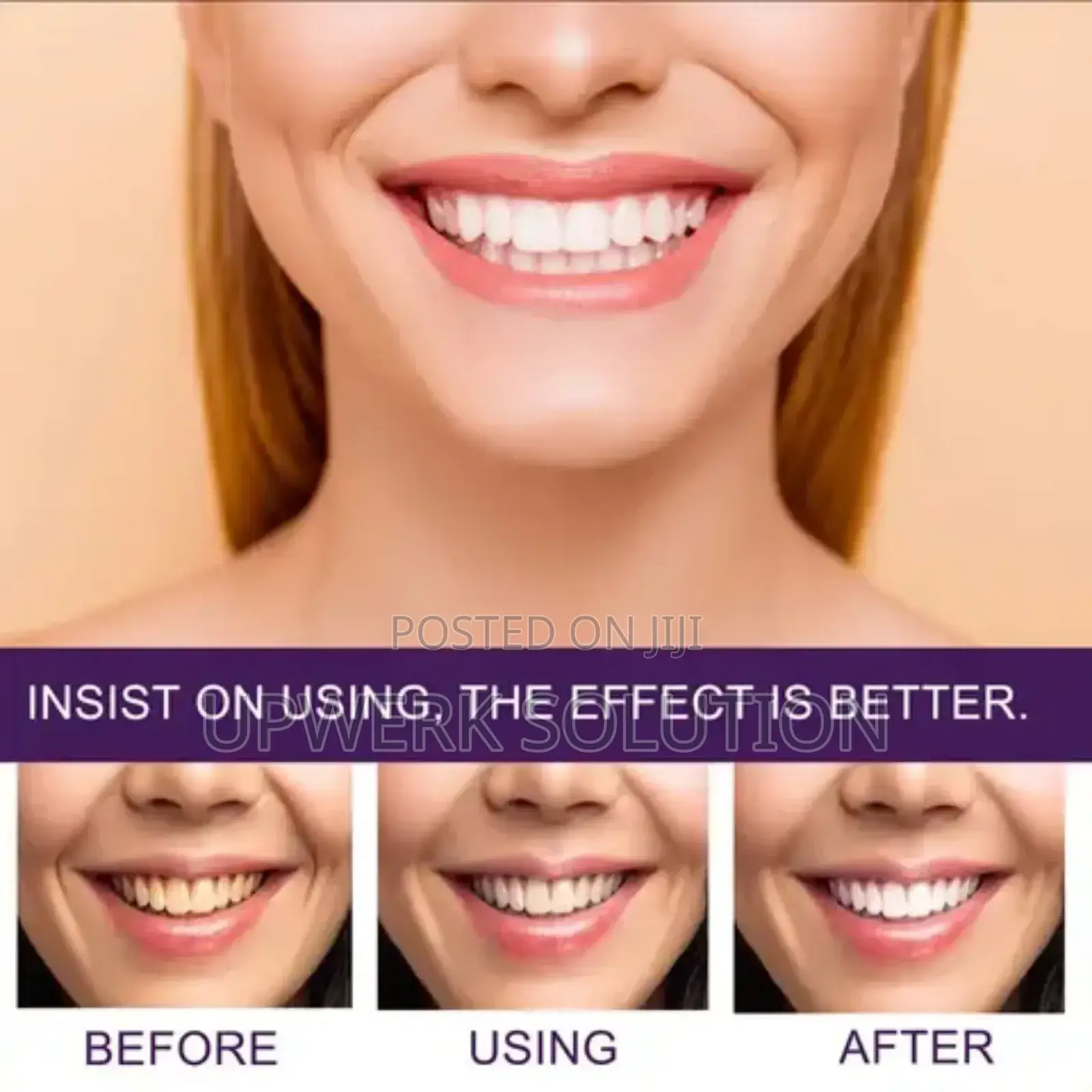 Eelhoe Purple Corrector for Teeth