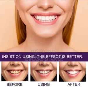 Eelhoe Purple Corrector for Teeth