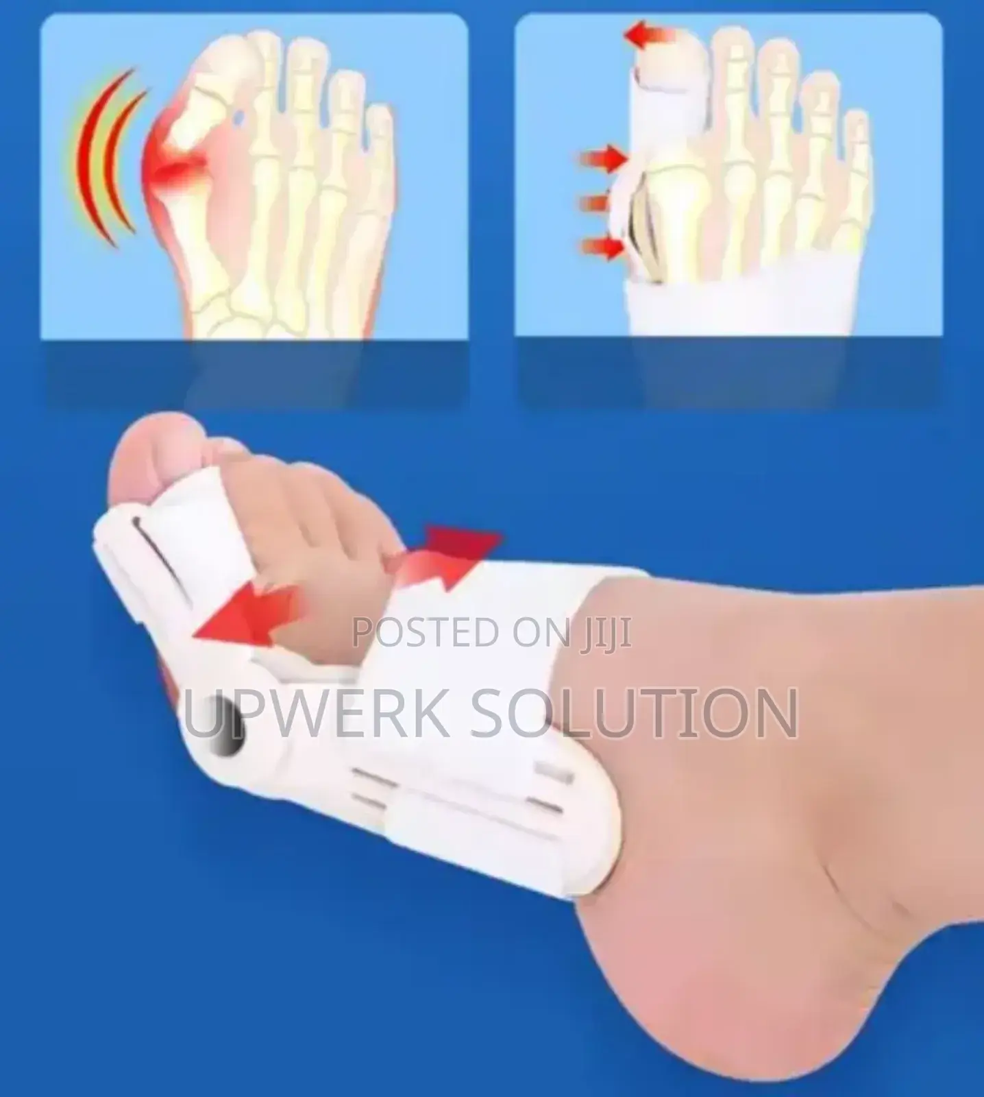 Orthopedic Beunion Toe Corrector