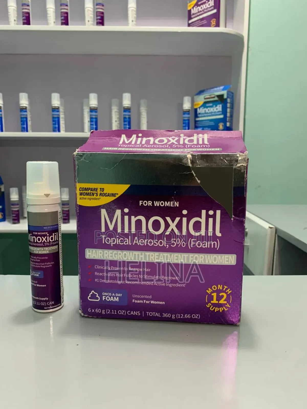 Minoxidil for Women