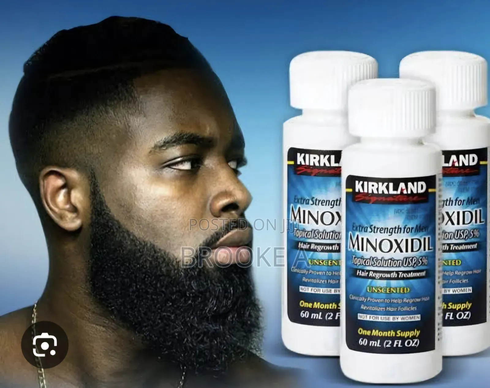 Minoxidil Hair Growth