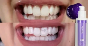 Eelhoe Purple Corrector for Teeth