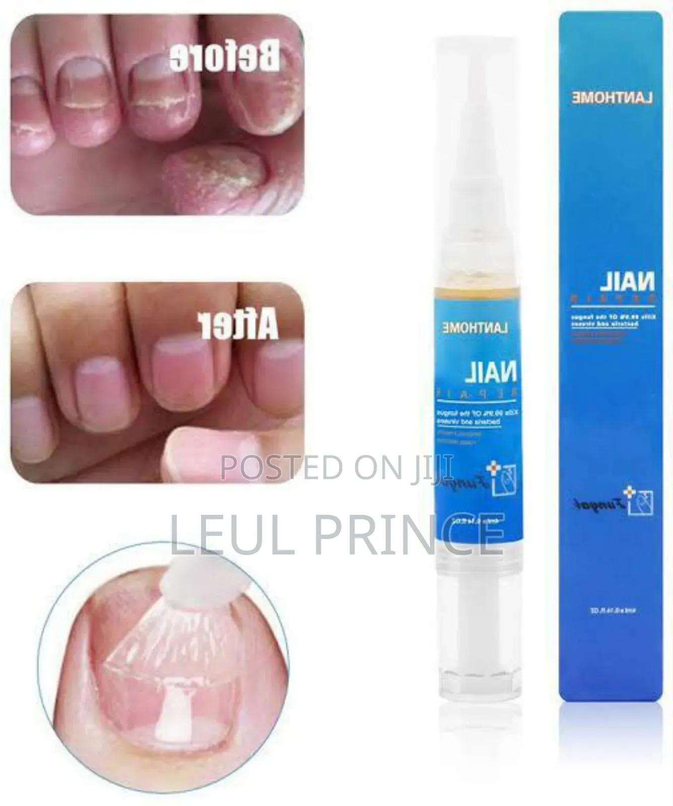 Lanthom Nail Repair