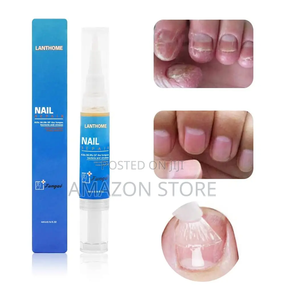 Lanthome Nail Repair